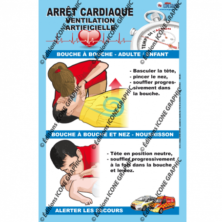 L'AFFICHE SIMPLIFIEE : ARRET CARDIAQUE - VENTILATION ARTIFICIELLE